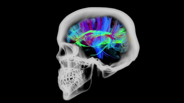 ¿Qué le ocurre al cerebro 30 minutos antes de la muerte?