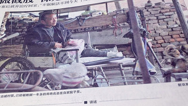 Un hombre se amputa una pierna en China por falta de recursos