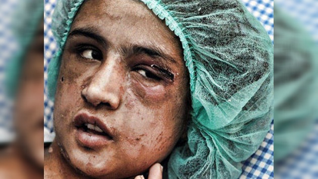 Rescatan a una niña afgana torturada por su marido por negarse a prostituirse