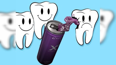 Las bebidas energéticas causan un desgaste irreversible al esmalte dental