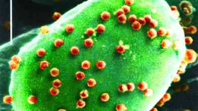 Hallan un virus nunca detectado en el organismo humano que afecta el cerebro
