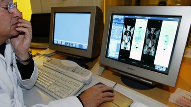 Descubren proteína capaz de frenar el cáncer de mama y la metástasis de pulmón