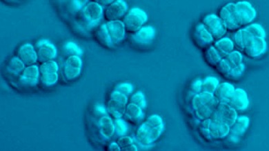 Microbios generadores de metano, culpables de la mayor extinción en la Tierra