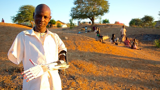 Crean prótesis de bajo costo imprimidas en 3D para víctimas de la guerra de Sudán