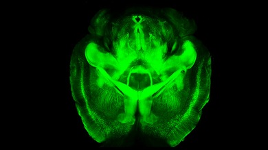 La ciencia nos ve las ideas: crean un método que vuelve transparente el cerebro