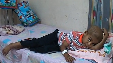 Niños de la guerra: cuando las armas químicas privan de futuro