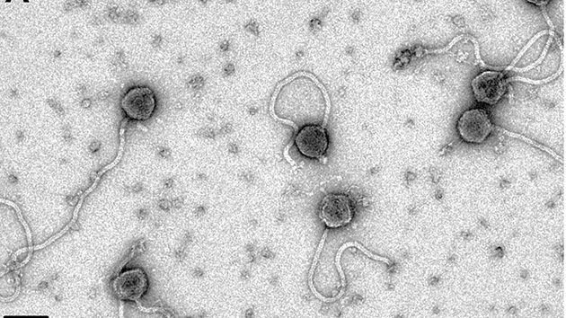 Hallan un virus que 'devora' las bacterias del carbunco
