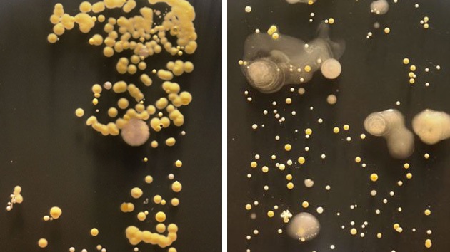 Fotos: Colonias de bacterias habitan en los teléfonos móviles