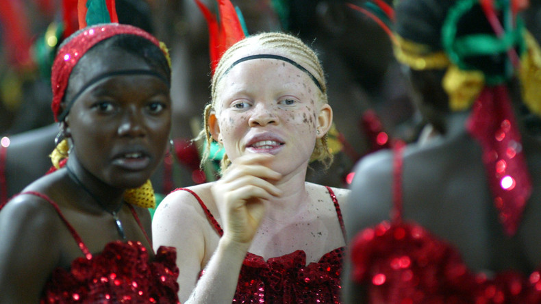 Simbabwe kürt erste "Miss Albino" - 85 Dollar als Preisgeld