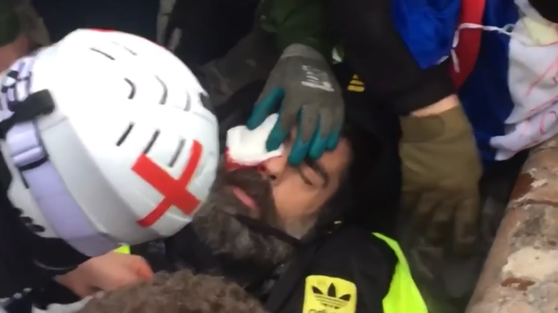 Paris: "Werde mein Auge verlieren" – Friedlicher Demonstrant durch Polizeigeschoss schwerverletzt