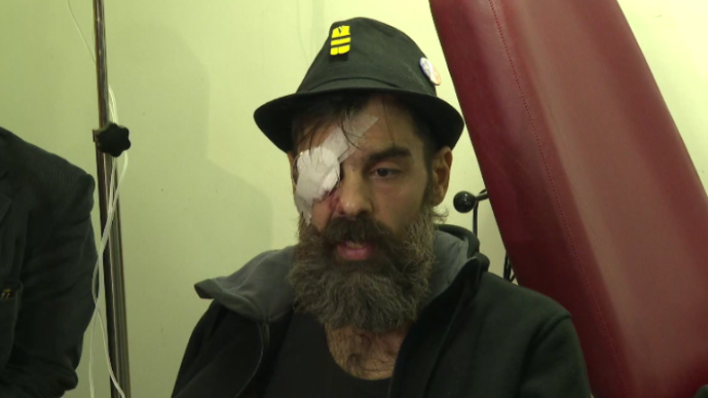 Verletzter Gelbwesten-Aktivist: "Mein Augapfel wurde genäht, aber ich werde weiter protestieren!"