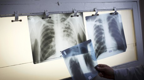 Wien: Skandal um Organspende im größten Krankenhaus Österreichs