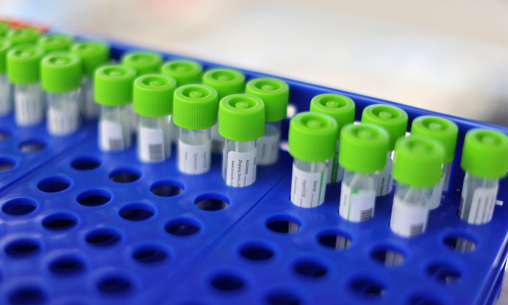 Epidemiologe Dr. Tom Jefferson zu PCR-Breitentestungen: "Irgendetwas läuft hier gewaltig schief"