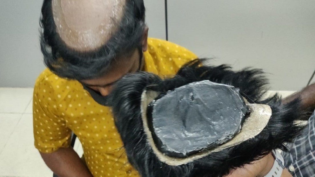 Gold unter Perücken: Indischer Zoll entlarvt Schmuggler dank auffälliger Frisuren