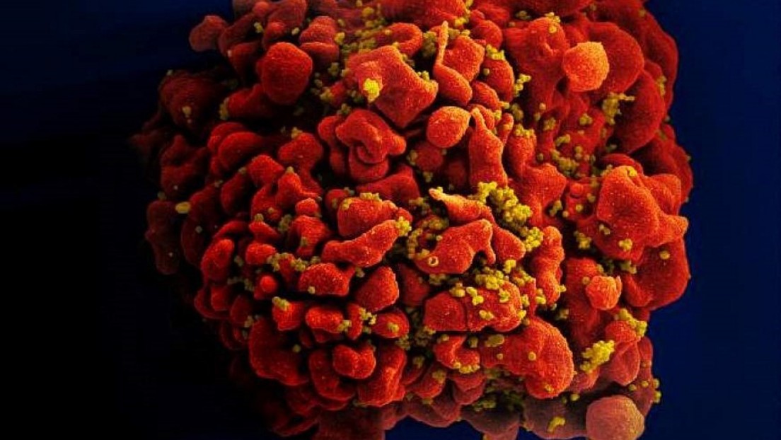 Universität Oxford startet HIV-Impfstoff-Studie