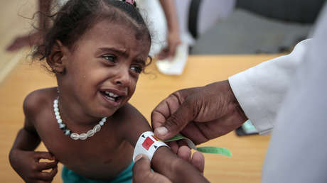 UNICEF schlägt Alarm: Mehrheit der Kleinkinder in Entwicklungsländern ist unterernährt