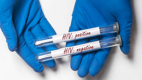 "Wunder des menschlichen Immunsystems": Frau aus Argentinien überwindet HIV ohne Behandlung