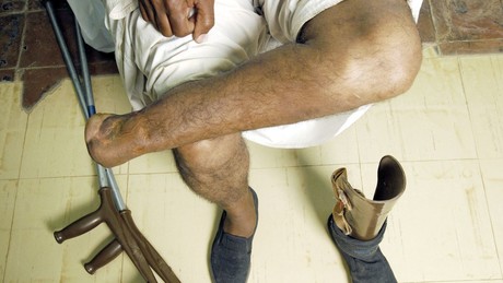 USA: Mehr als 100.000 Todesfälle und mehr Amputationen durch Diabetes