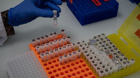 Hepatitis "unbekannten Ursprungs" breitet sich aus – Dutzende Fälle bei Kindern