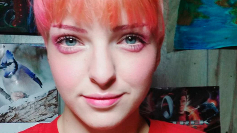 Hangover eyes: Odd make-up & injection craze form bizarre trend