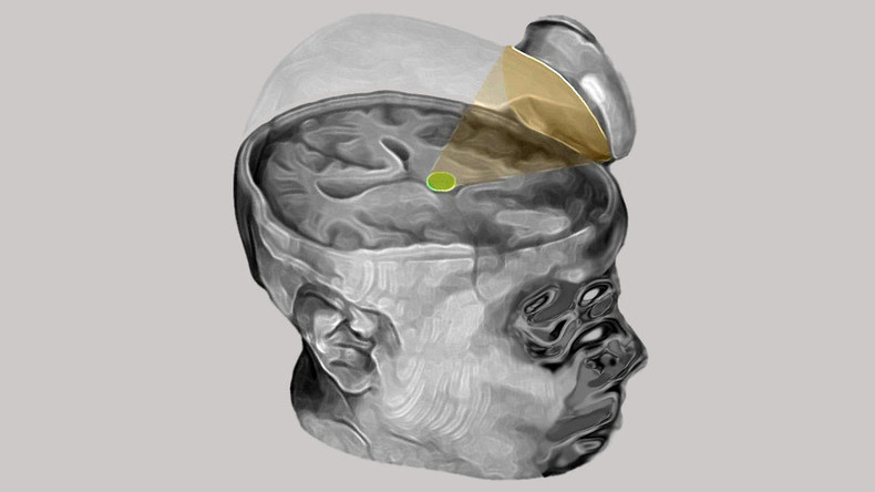 Coma patient ‘regains full consciousness’ following novel ultrasound procedure