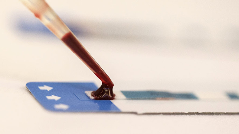 HIV 'epidemic': Official says nearly every 50th resident of Russian Urals city infected