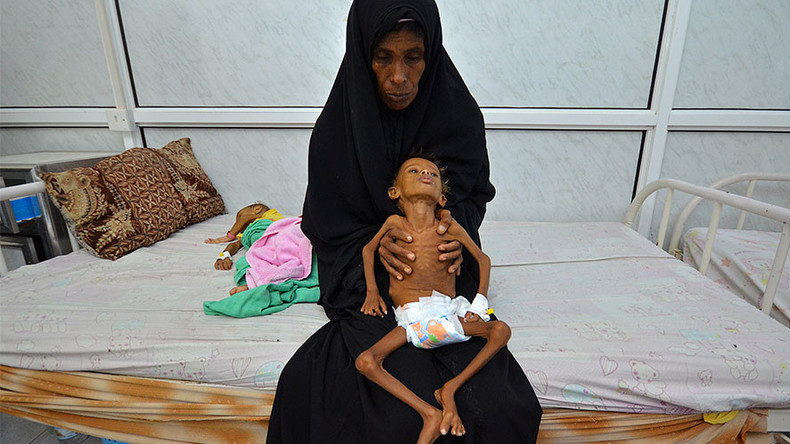 Child malnutrition at ‘all-time high’ in Yemen, UNICEF claims in alarming report