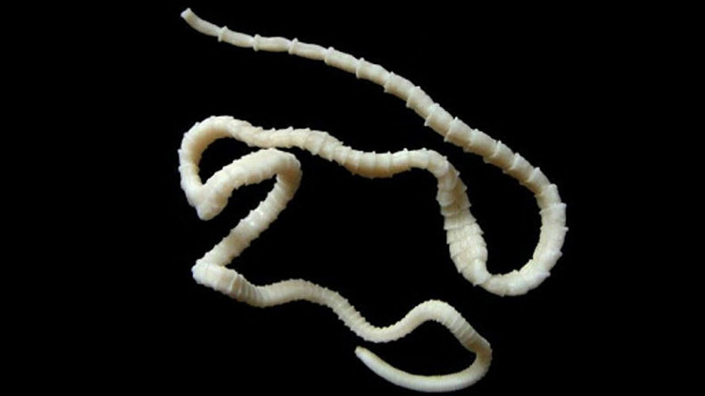 Mammoth 6ft live tapeworm removed from man’s gut through his mouth (GRAPHIC PHOTOS)