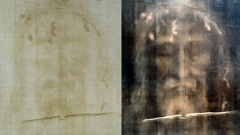 Turin Shroud is stained with the blood of a torture victim, new research reveals