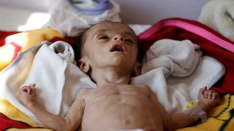 UK ‘complicit in promoting famine’ in war-torn Yemen
