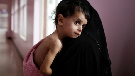‘Yemen is one of the worst places to be a child right now’ – UNICEF representative