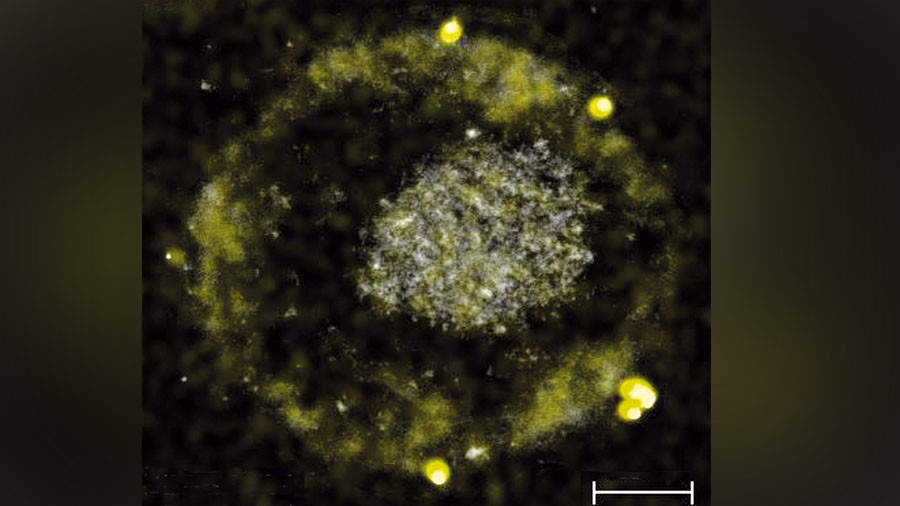 Toxic metal into nuggets: Secrets of gold-pooping bacteria unraveled by scientists