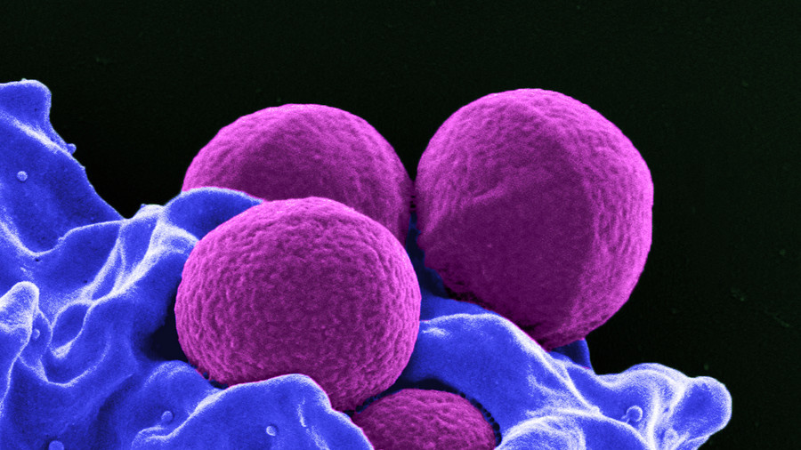 New ‘nightmare bacteria verging on untreatable’ now in every US state