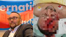 German AfD MP brutally beaten in ‘politically-motivated attempted assassination’ (GRAPHIC)
