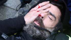 ‘I'll lose my eye’: Prominent Yellow Vest activist suffers HORRIFIC injury in Paris protests
