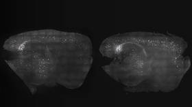 Could light and sound cure Alzheimer’s? Exciting mice experiment suggests promising potential