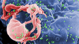 HIV breakthrough: Scientists discover resistance gene in patients with muscular disease