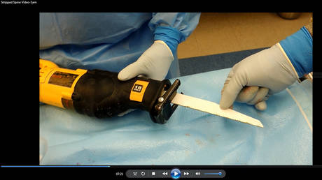A training video by Biological Resource Center shows a construction saw used by technicians to remove a man’s spine. © BRC via REUTERS