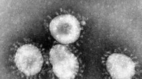 Australian scientists create lab-grown coronavirus in effort to develop vaccine and eventual cure (VIDEO)
