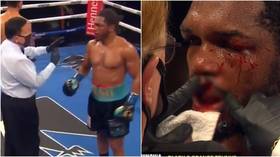 'One of the most gruesome cuts you'll ever see': Fans recoil as boxer Tureano Johnson suffers horrific lip injury (GRAPHIC VIDEO)