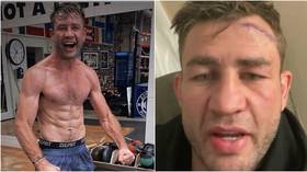 'Looks like he was hit with an axe': Former Conor McGregor sparring partner Van Heerden suffers GROTESQUE cut in ring (VIDEO)