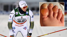 ‘It was really bad’: Ski star admits to frozen penis nightmare after watching racers risk amputation horror from brutal frostbite