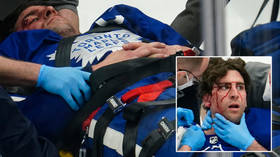 ‘He’s lucky to be alive’: NHL star John Tavares recovering after taking sickening knee to the face (VIDEO)