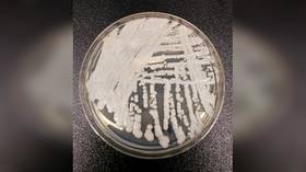 Spate of drug-resistant fungal infections found in Texas and DC hospitals, CDC warns