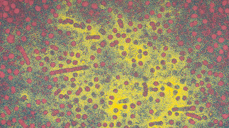 An electron microscope image of the hepatitis B virus © Flickr / Sanofi Pasteur
