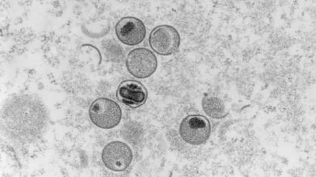 FILE PHOTO: An electron microscope image of the monkeypox virus, taken by the Robert Koch Institute, Berlin, Germany, 2004 © AFP / Freya Kaulbars