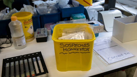 A bucket with suspected monkeypox samples at the microbiology laboratory of La Paz Hospital, June 22, 2022, Madrid, Spain.