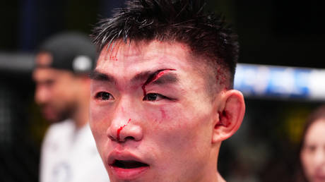 UFC fighter suffers devastating loss thanks to horrific cut (VIDEO)