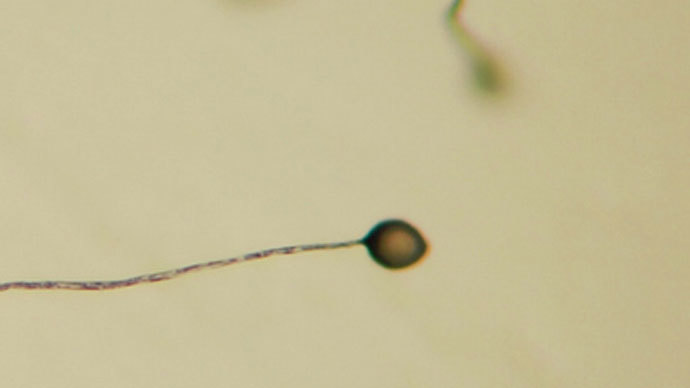 Simple amoeba can help fight Alzheimer's – research