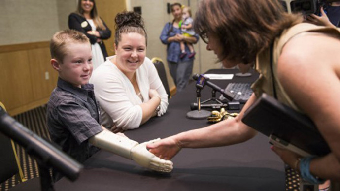 ​‘I can now climb trees’: 6yo kid gets prosthetic arm from 3D printer